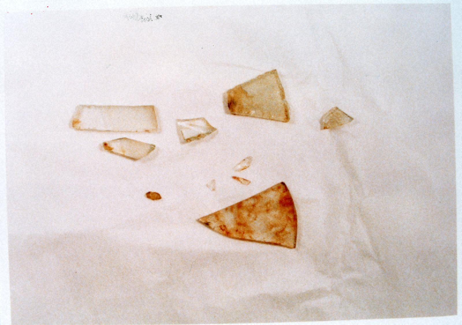 Surgically removed glass fragment
